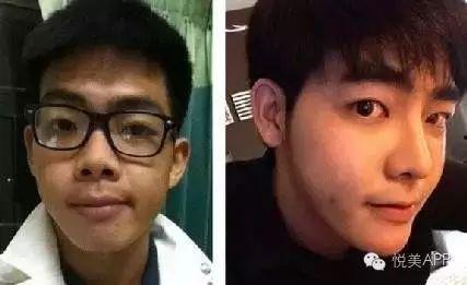 男网红整容脸吃瓜视频,吃瓜群众热议的整形真相  第1张